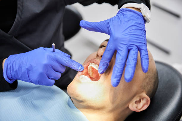 Best Emergency Wisdom Teeth Removal in West Pittston, PA