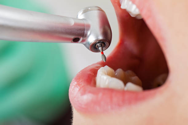 Best Emergency Tooth Extraction in West Pittston, PA